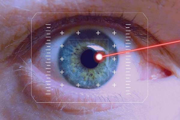 LASIK surgery - Retinal Lasers