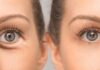 Oculoplastic Surgery Unveiled Types and What They Treat - Clairevision Eye Care