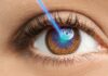 Are you a candidate of Lasik Eye Surgery? - Clairevision Eye Hospital