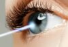 LASIK vs Cataract Surgery: Which is Right for You? | Clairevision Eye Care